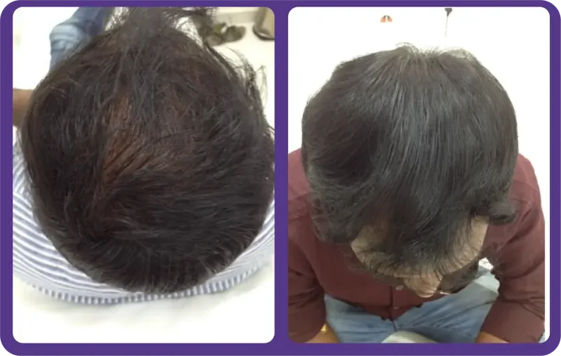 Root Revival Therapy Before & After
