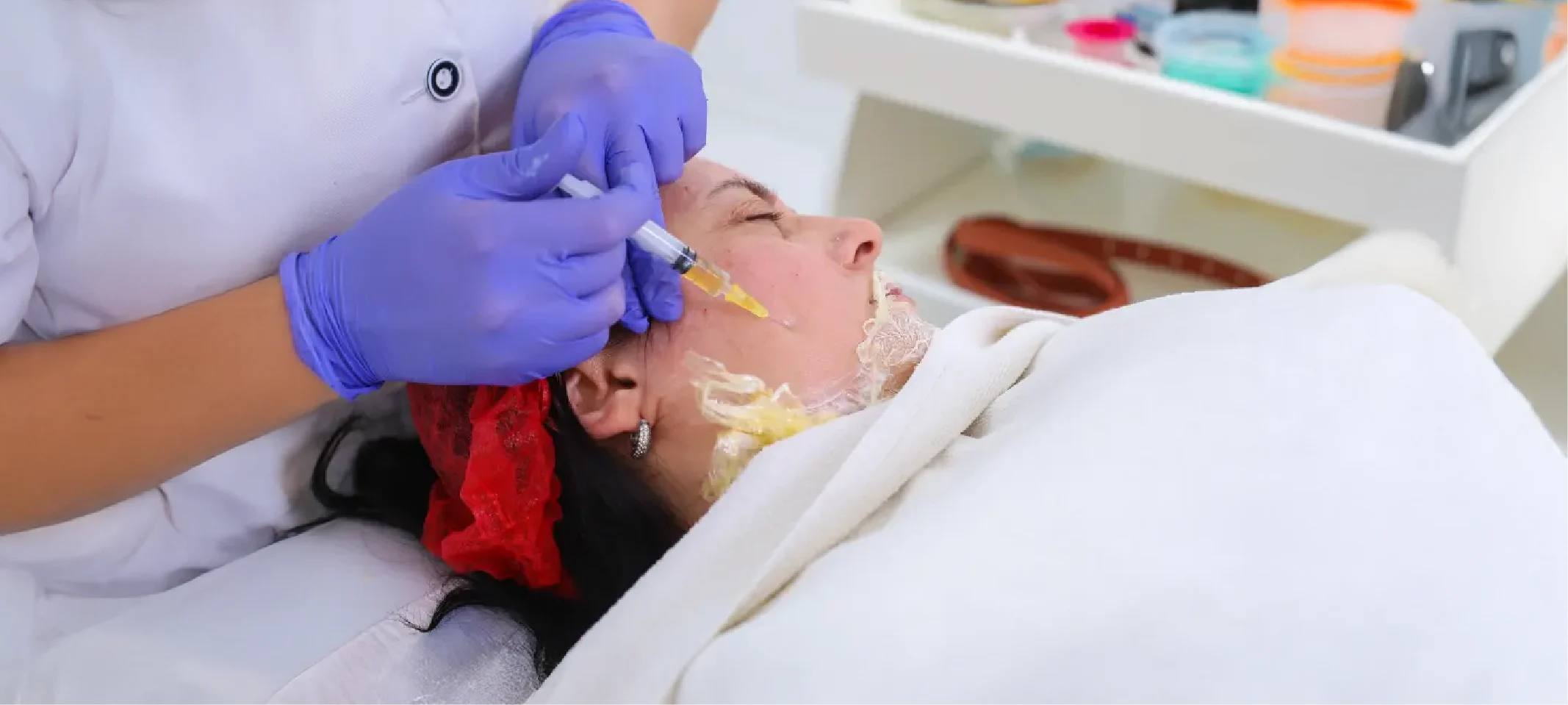 Acne and Acne Scar Treatment