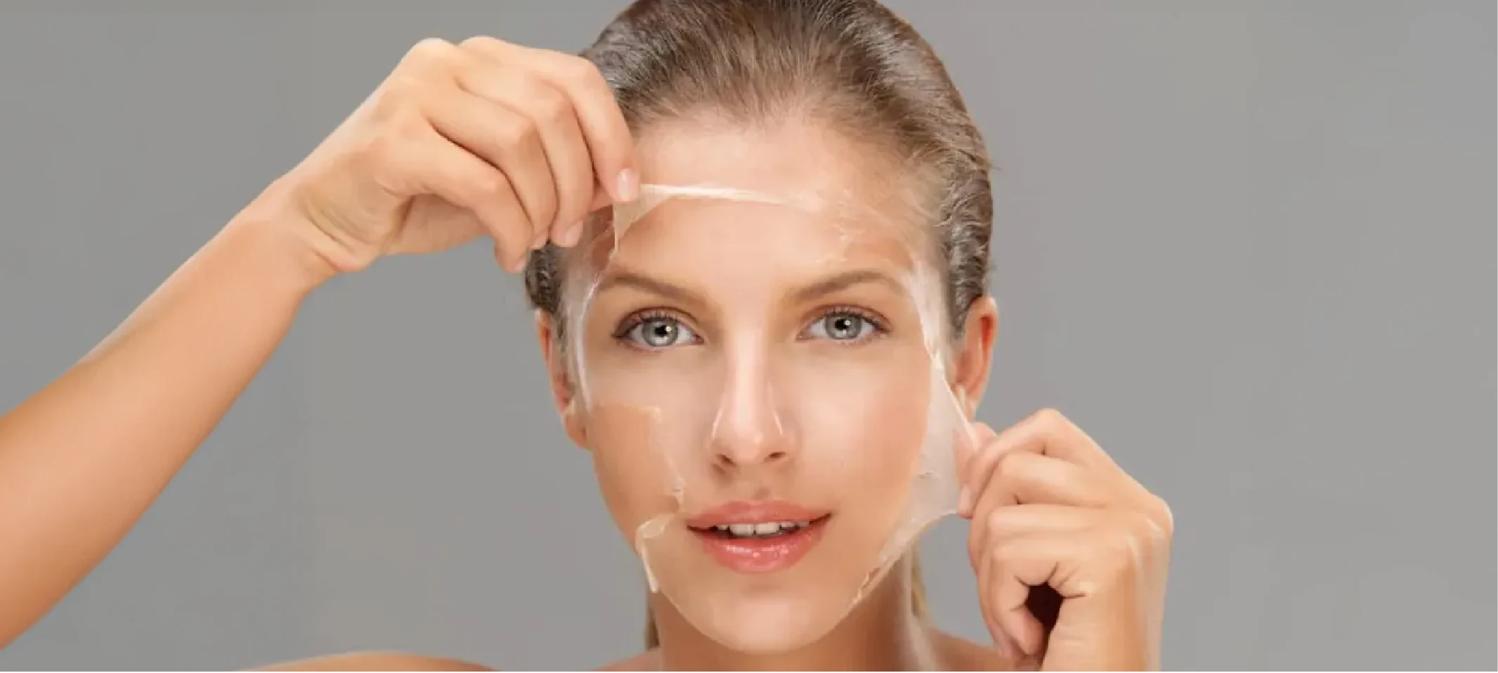 Chemical Peel Treatment