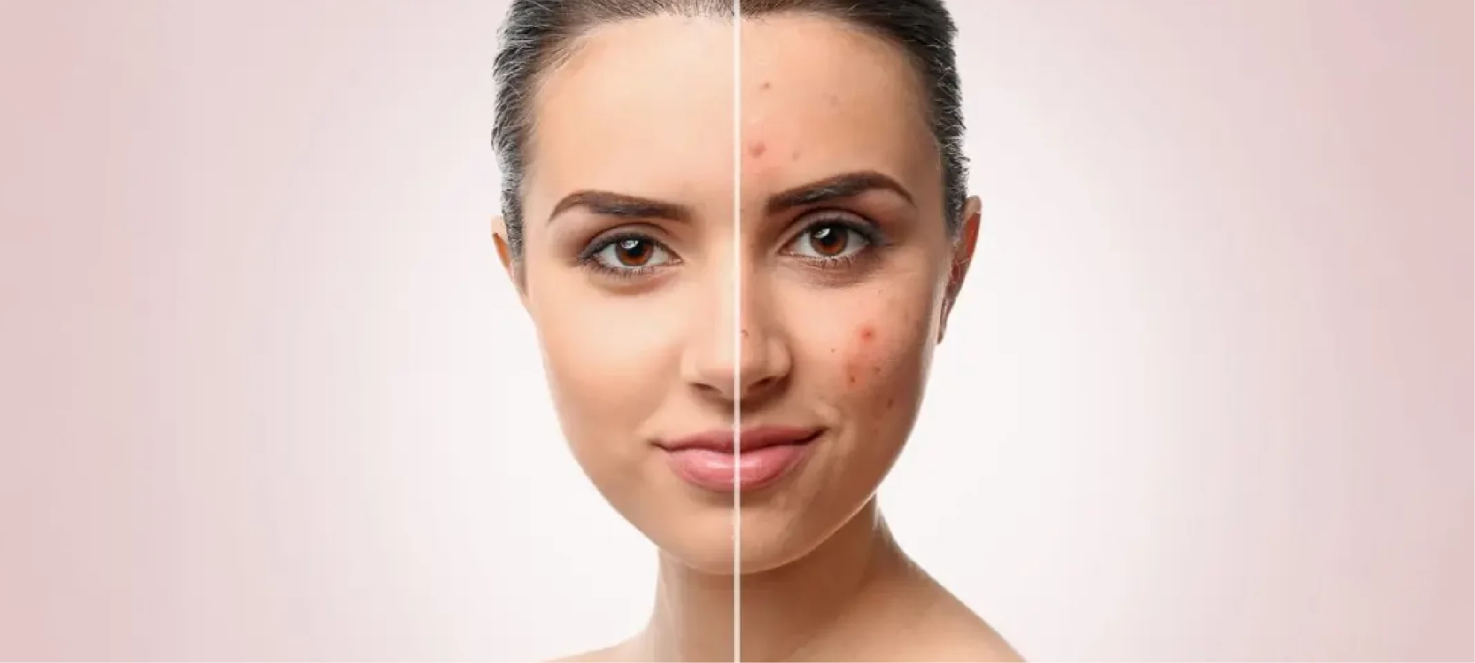 Laser Toning Treatment