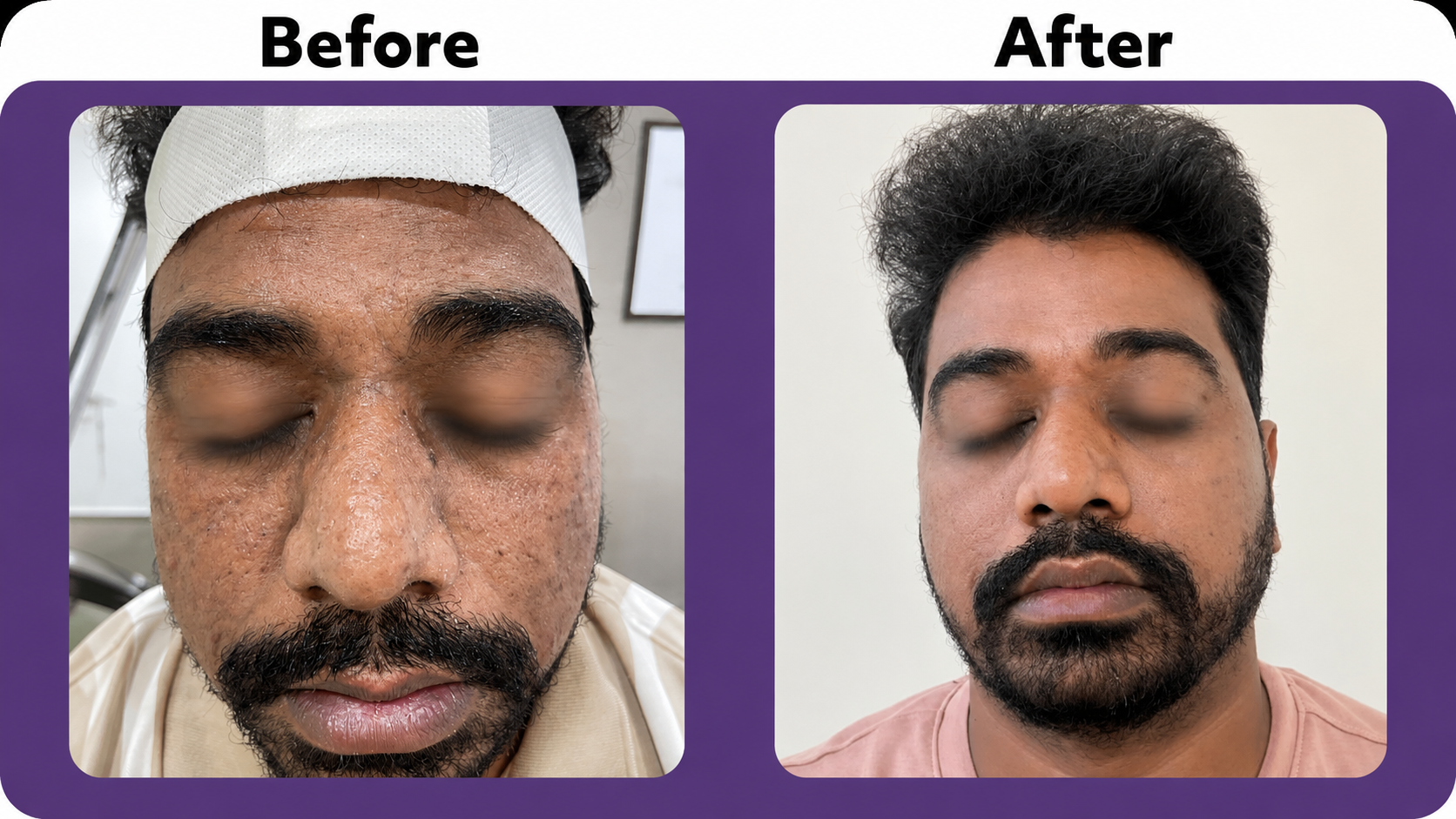 Before After